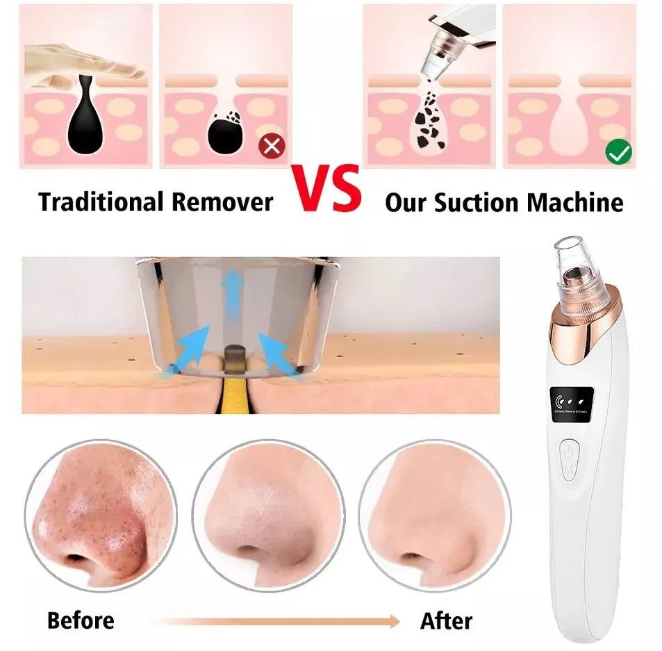 Using rechargeable face vacuum derma suction tool for pore cleansing